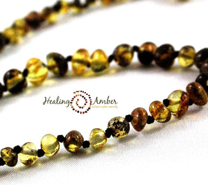 Healing Amber | 13" Amber Necklace