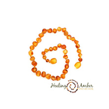 Load image into Gallery viewer, Healing Amber | 11&quot; Amber Necklace