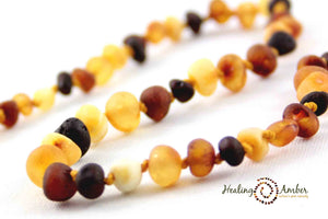 Healing Amber | 13" Amber Necklace